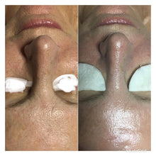 Load image into Gallery viewer, A Custom Facial from Valley of the Moon Skincare | Value: $100